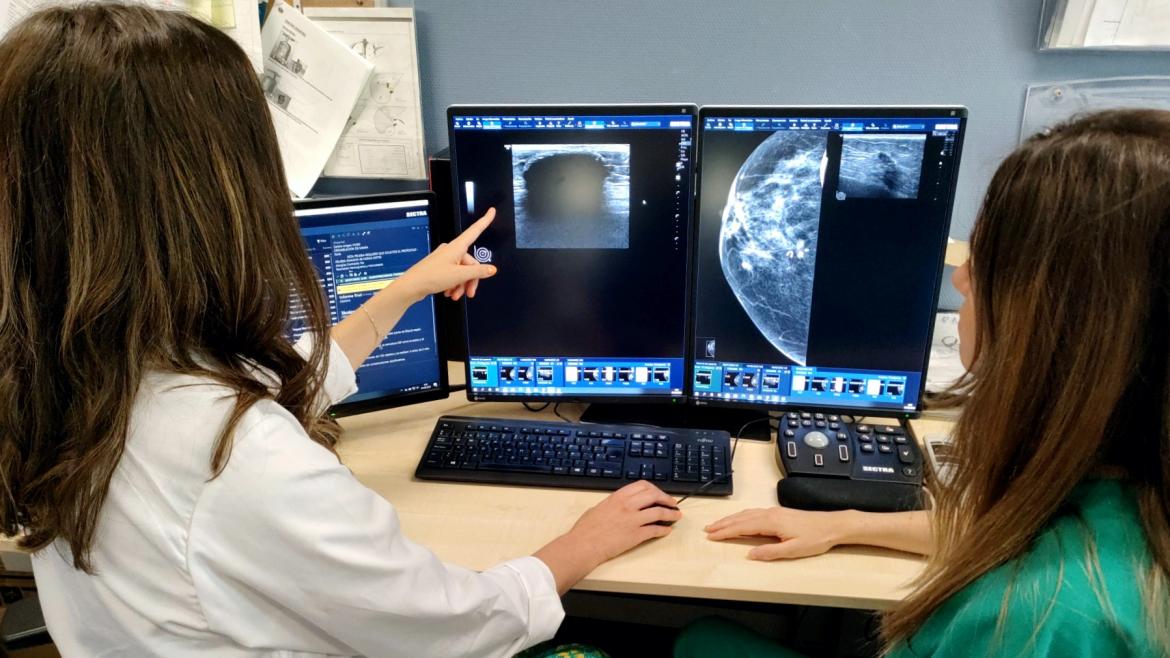 El Hospital público Severo Ochoa de la Comunidad de Madrid incorpora la crioablación en el tratamiento del cáncer de mama