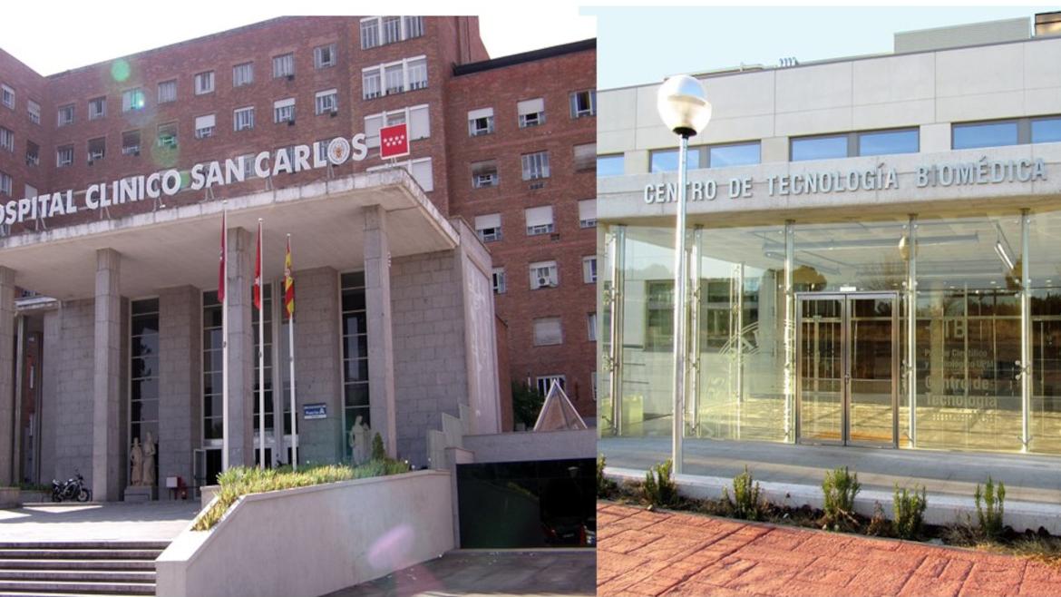 Investigadores del Hospital Clínico San Carlos desarrollan un nuevo procedimiento para diagnosticar Alzheimer