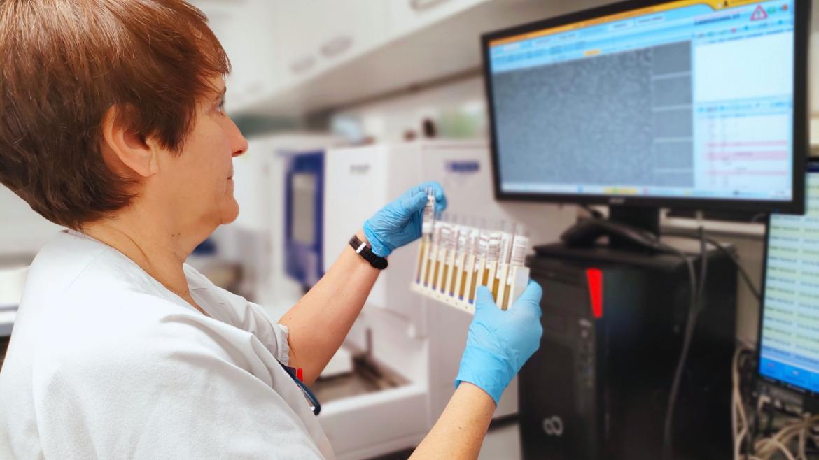 Bioquímica del Hospital Severo Ochoa explica la importancia de un análisis exhaustivo de orina para descartar o detectar patologías